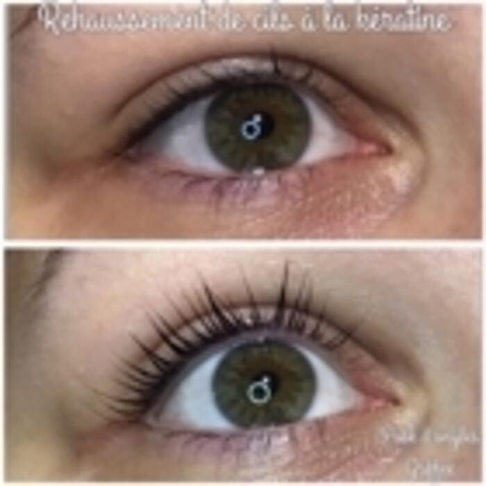 Images Pose D'Ongles Griffée