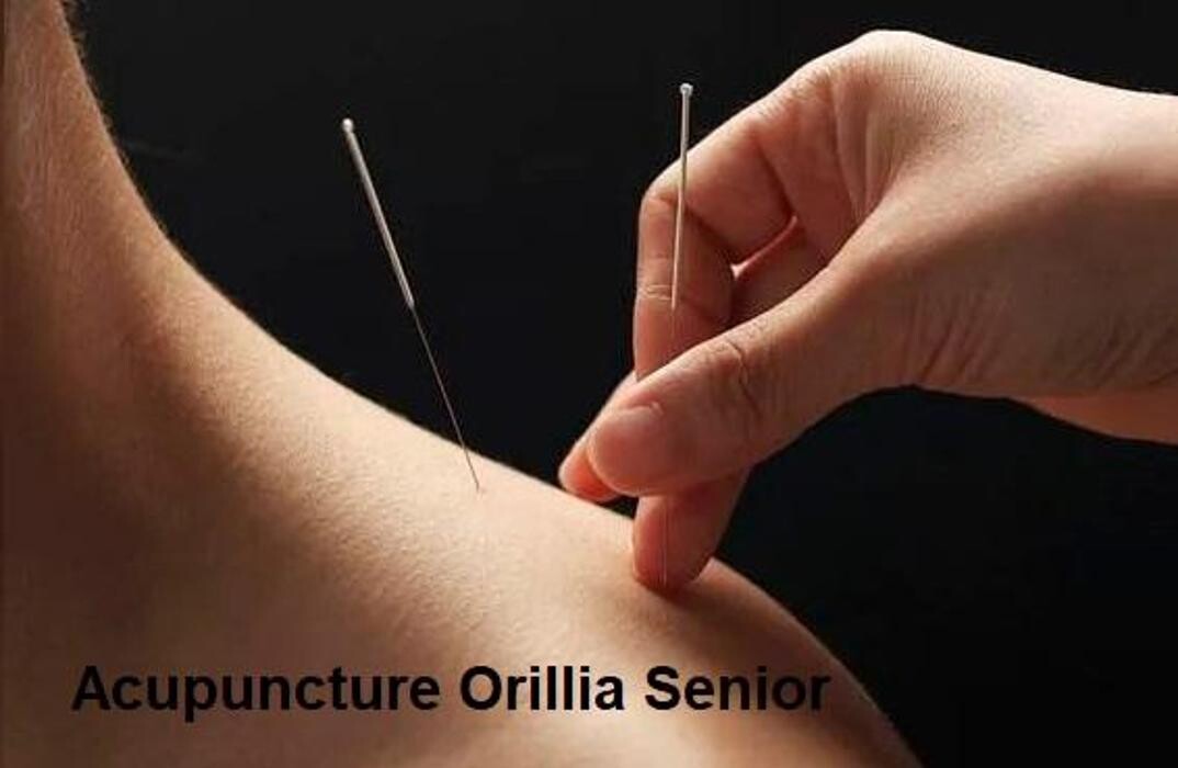 Images TCM Acupuncture Orillia Cindy