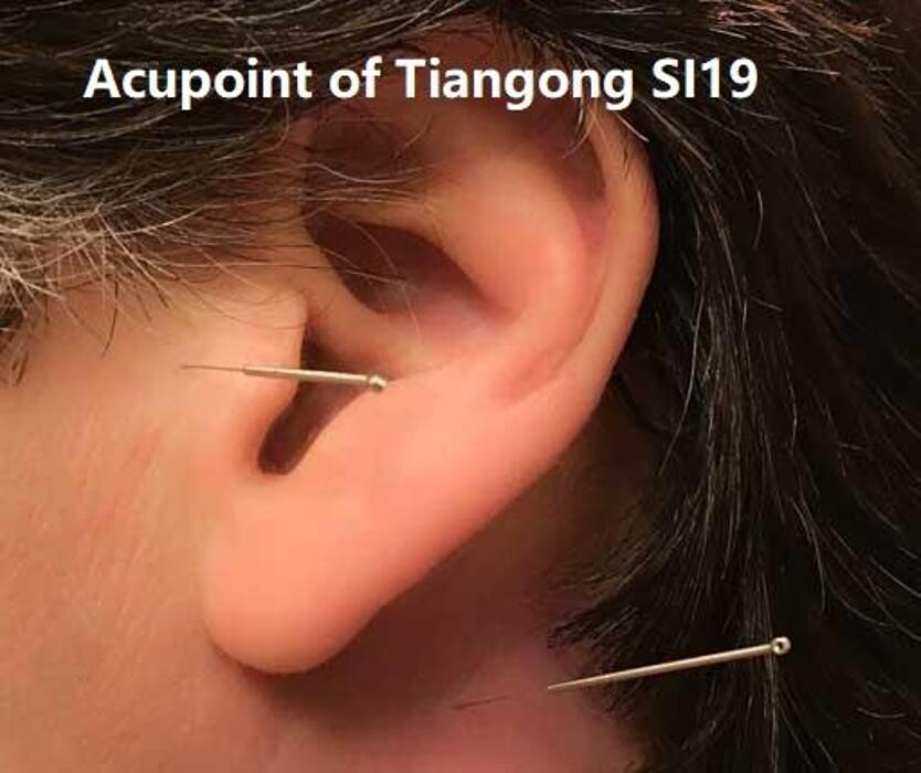 Images TCM Acupuncture Orillia Cindy