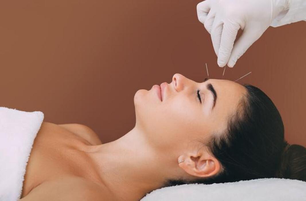 Images TCM Acupuncture Orillia Cindy