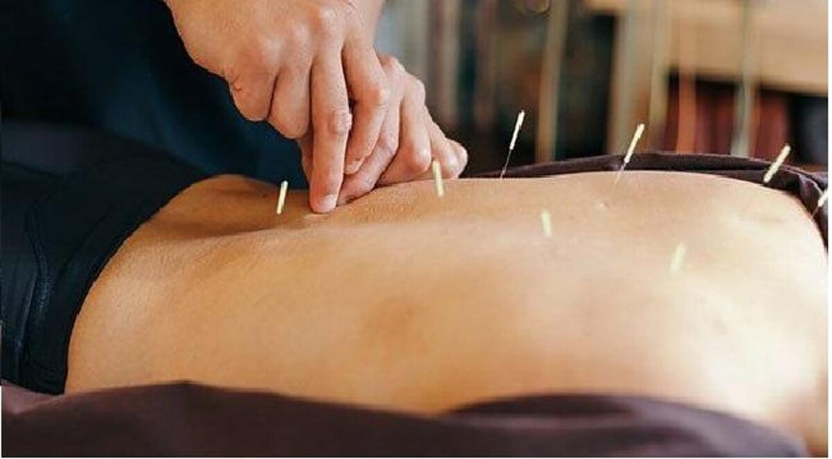 Images TCM Acupuncture Orillia Cindy