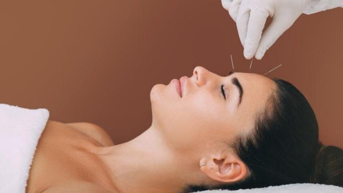 Images TCM Acupuncture Orillia Cindy