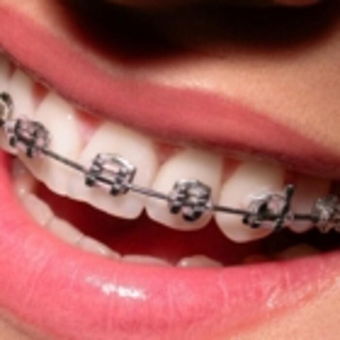 Images GD Orthodontics