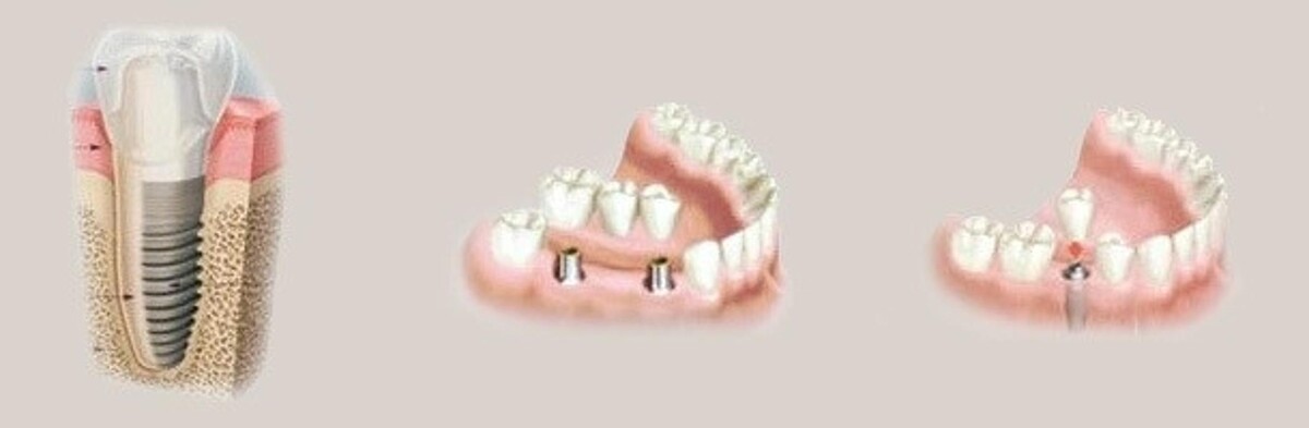 Images Southridge Dental