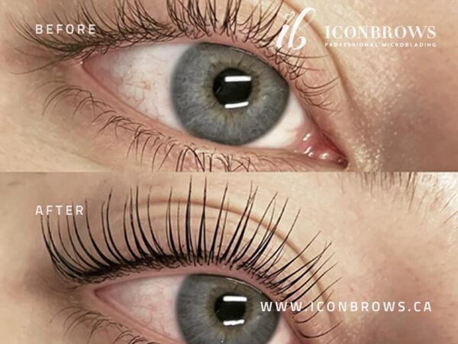 Images Iconbrows - Eyebrow Perfection | Professional Microblading