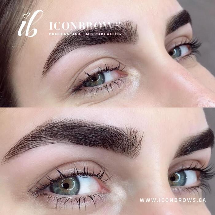 Images Iconbrows - Eyebrow Perfection | Professional Microblading