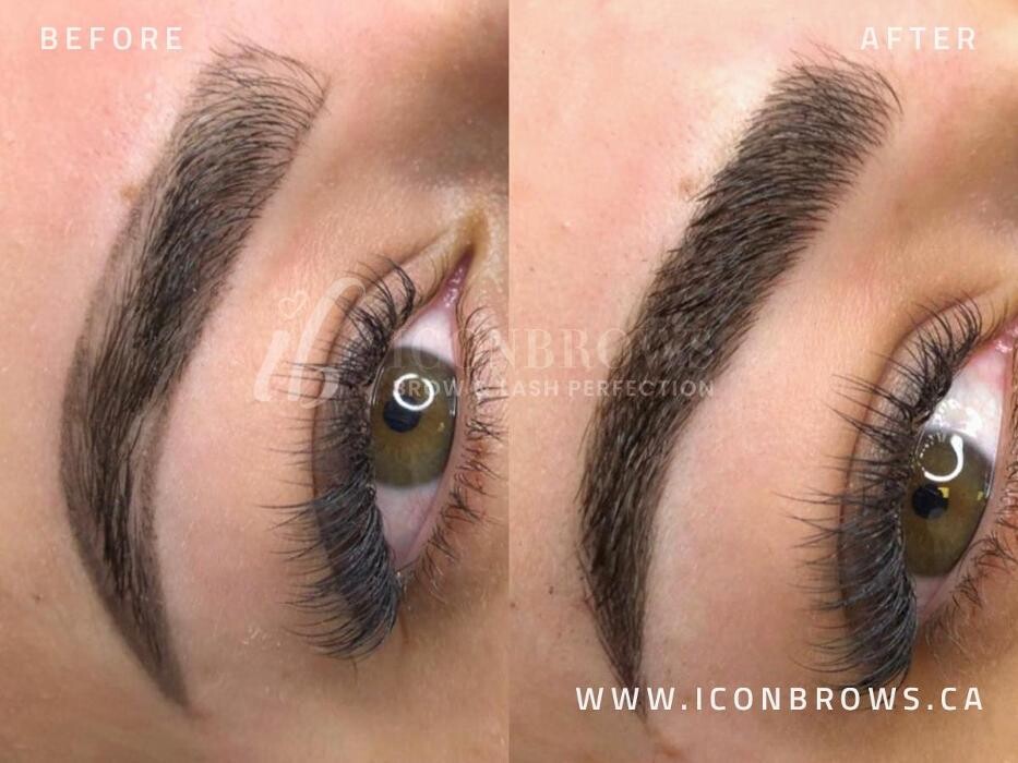 Images Iconbrows - Eyebrow Perfection | Professional Microblading