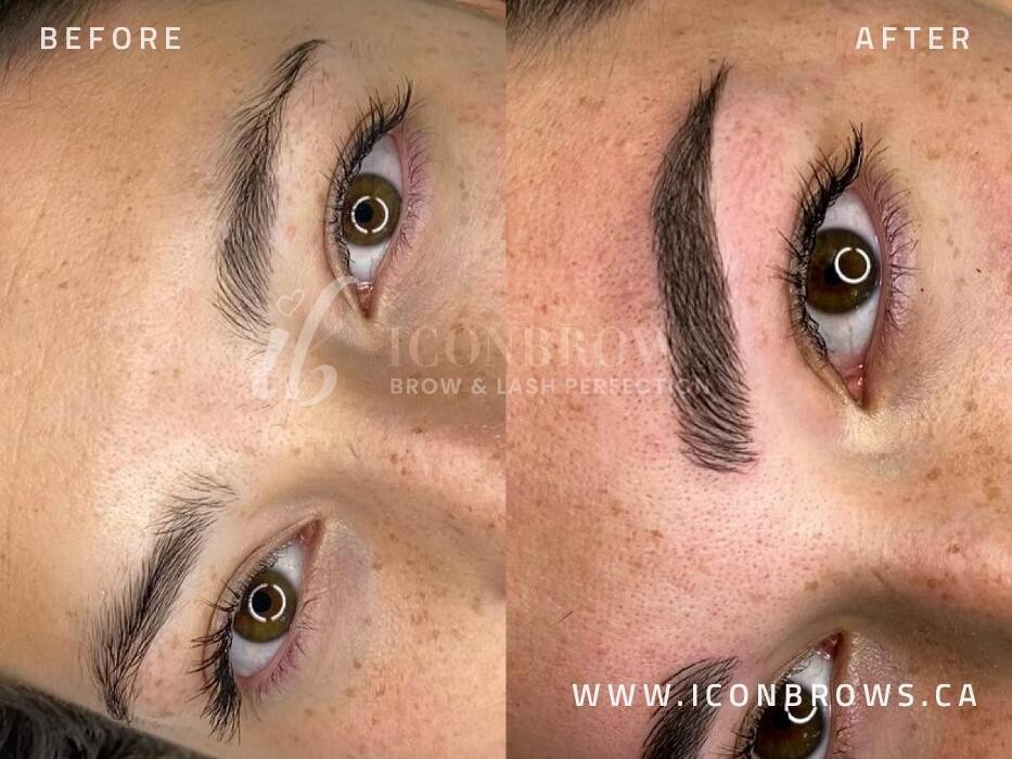 Images Iconbrows - Eyebrow Perfection | Professional Microblading