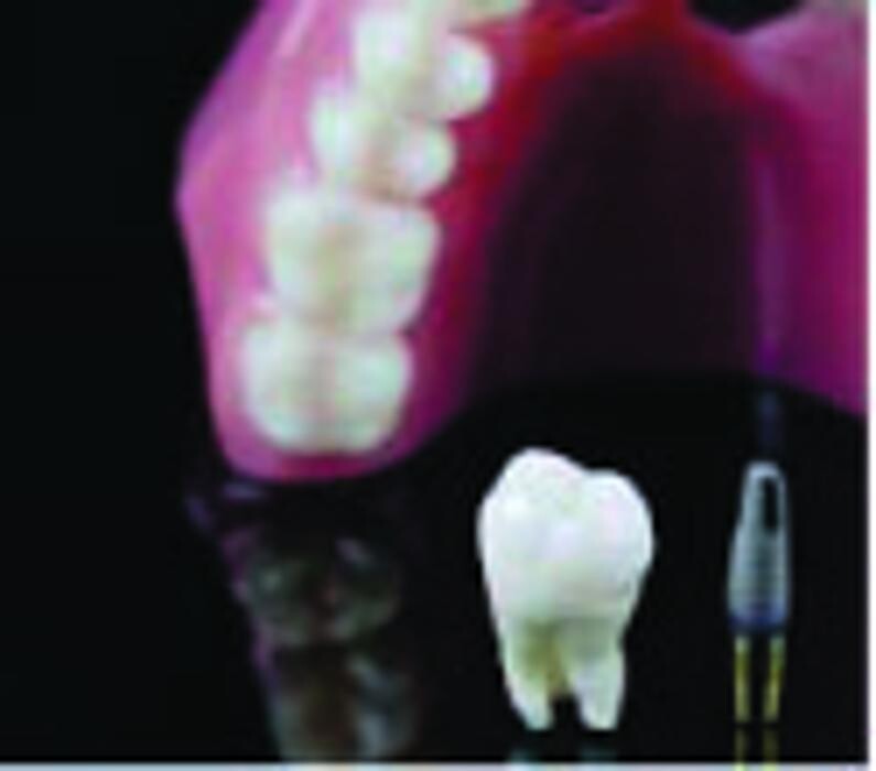 Images Confident Smiles Denture Solution