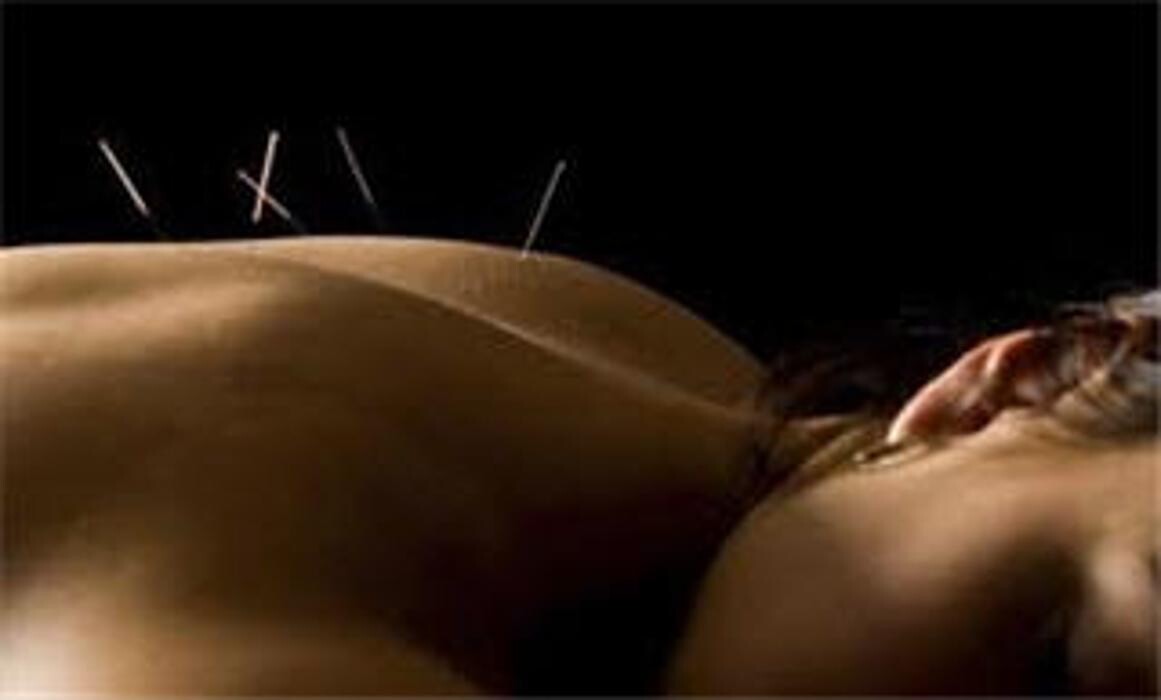 Images Acupuncteure Isabelle Paquette