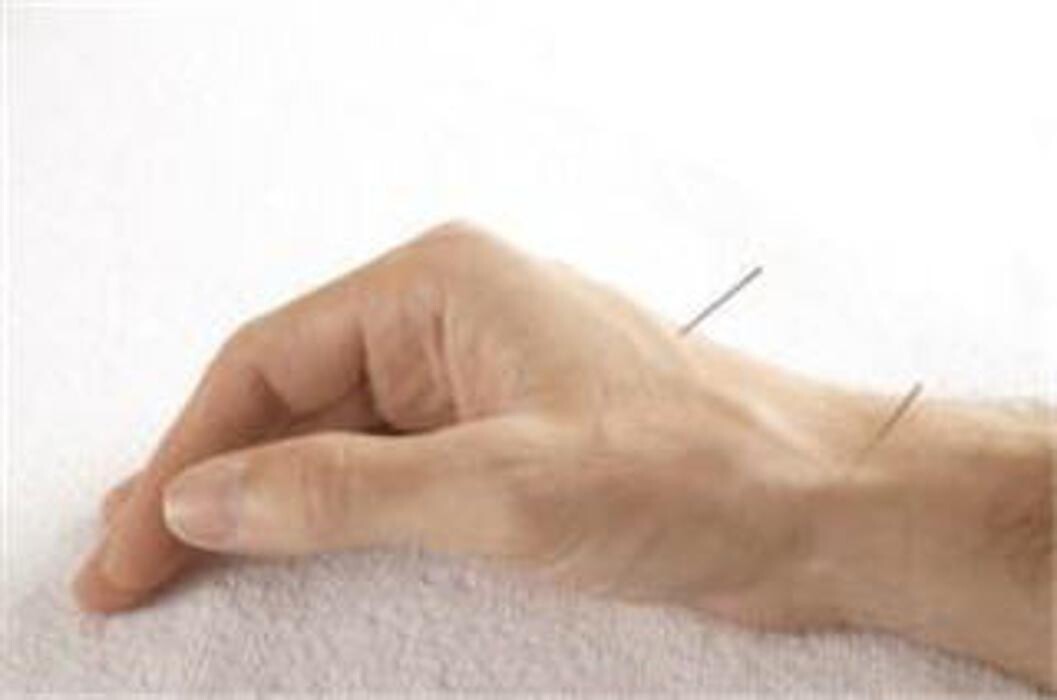 Images Acupuncteure Isabelle Paquette