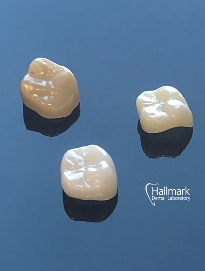 Images Hallmark Dental Laboratory Ltd