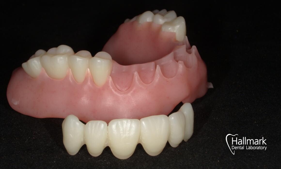Images Hallmark Dental Laboratory Ltd
