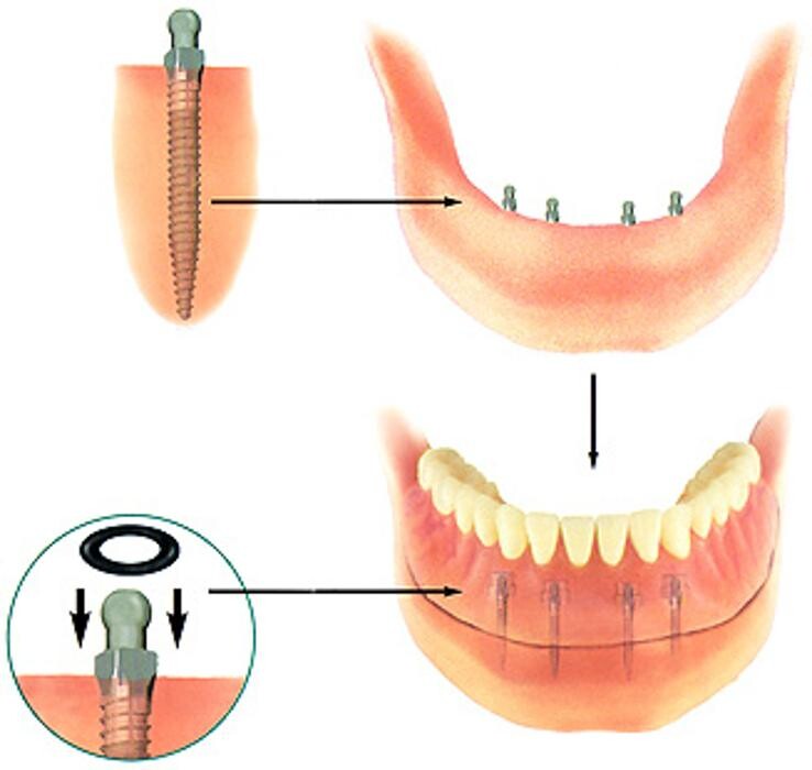 Images Marcous Denture Clinic