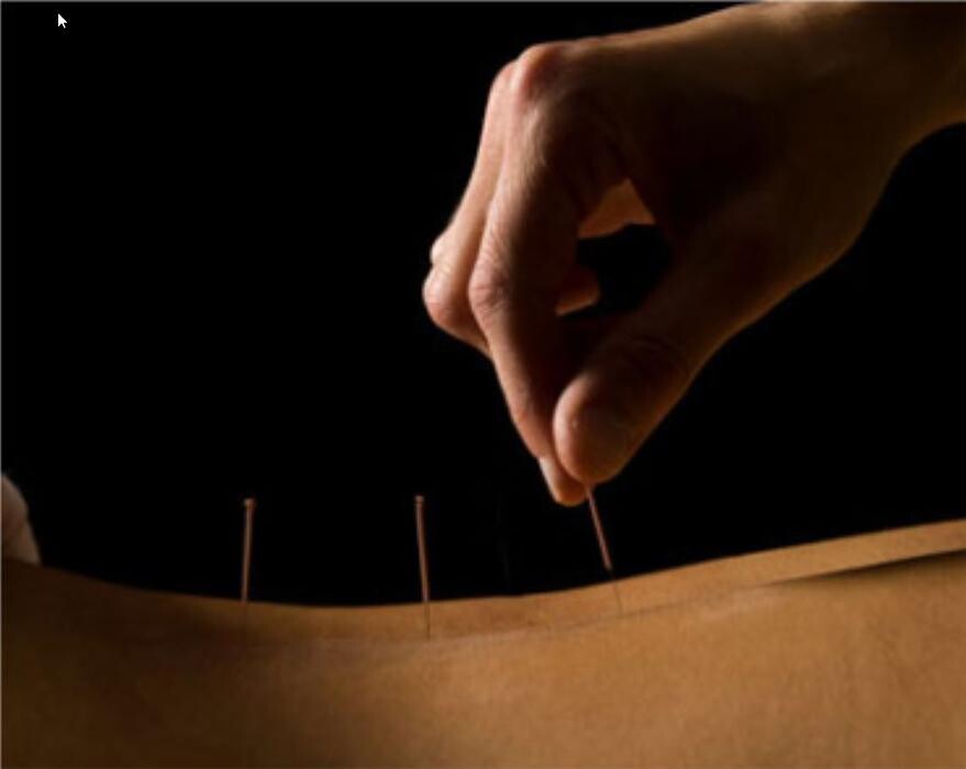 Images Clinique D'Acupuncture Johanne Marcotte
