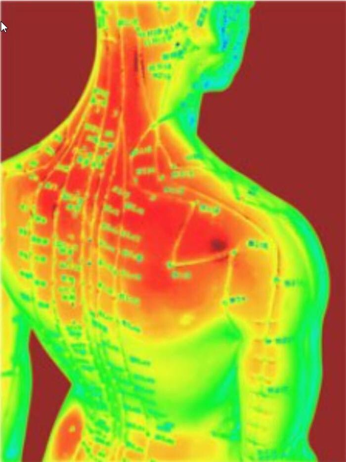 Images Clinique D'Acupuncture Johanne Marcotte