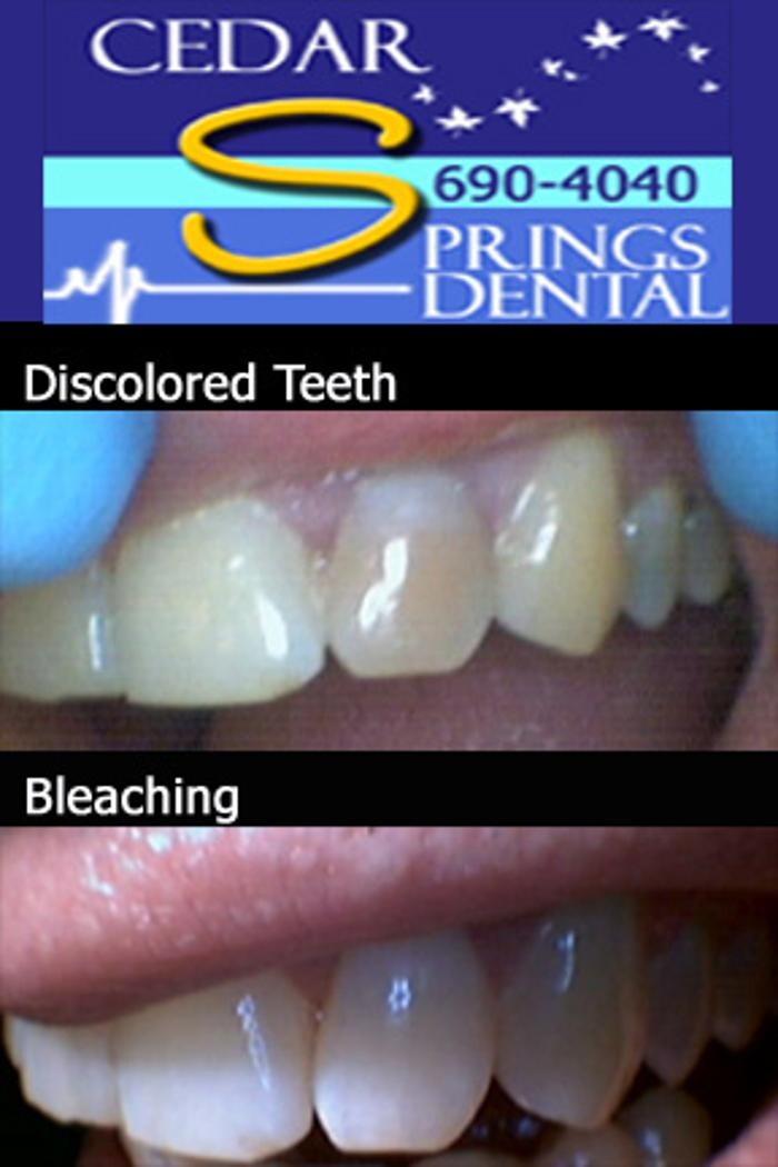 Images Cedar Springs Dental