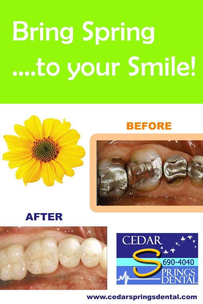 Images Cedar Springs Dental