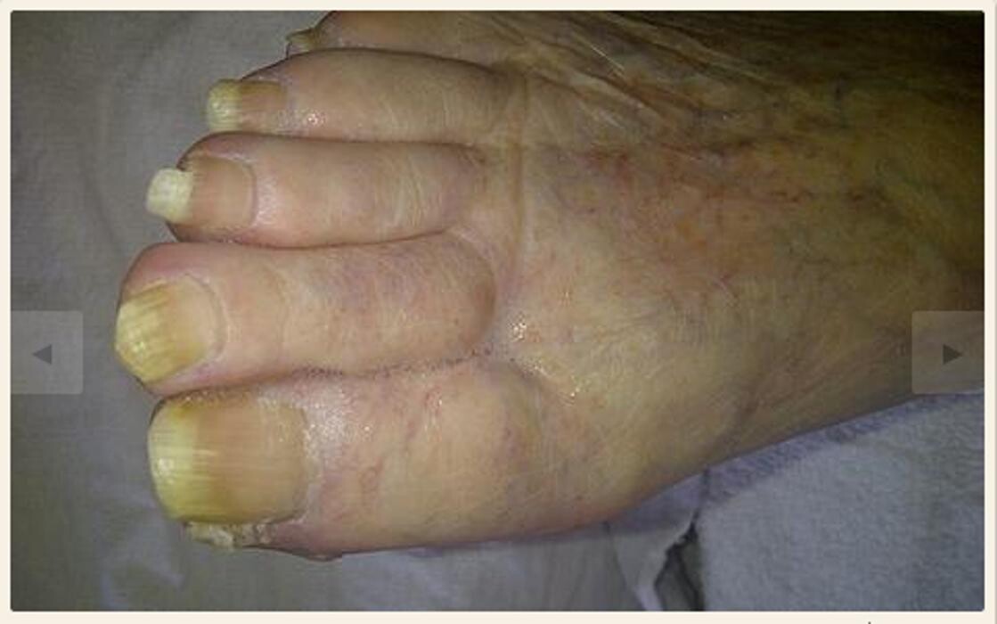 Images 2fixfeet