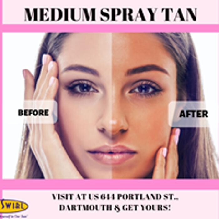 Images Sunswirl Laser and Esthetics
