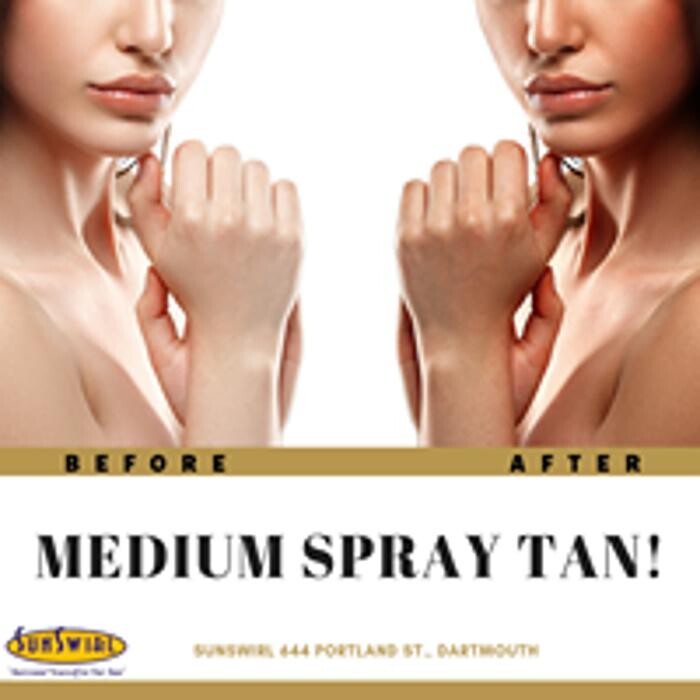 Images Sunswirl Laser and Esthetics