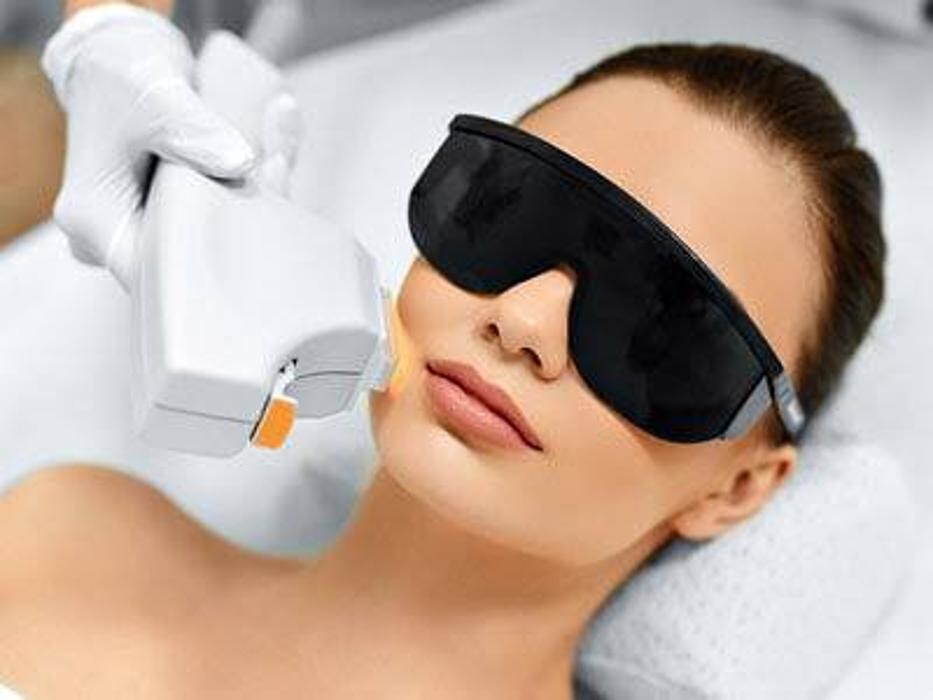 Images Sunswirl Laser and Esthetics