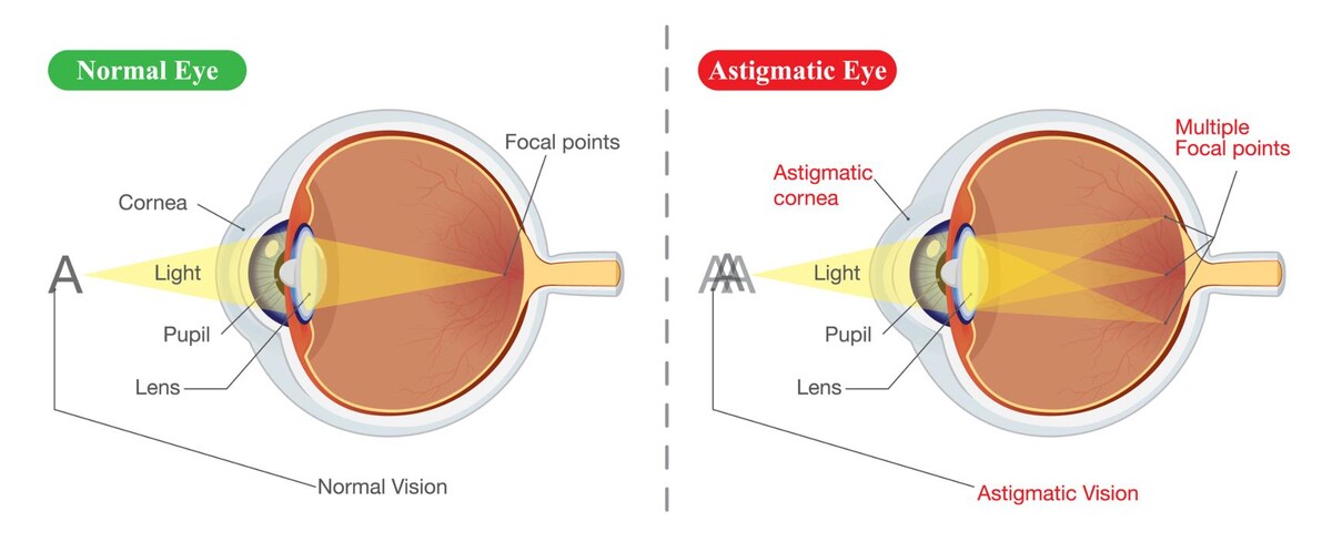 Images Mission Creek Optometry