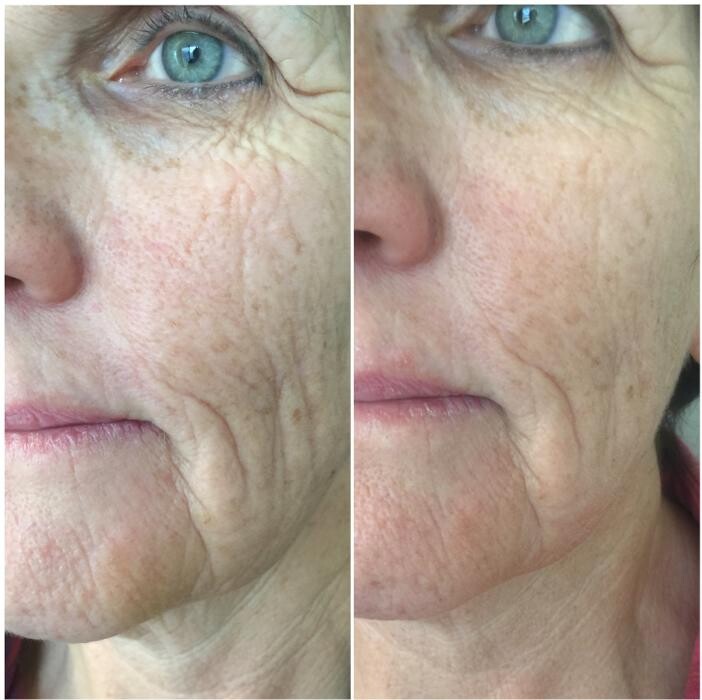 Images Julia Skin Beauty