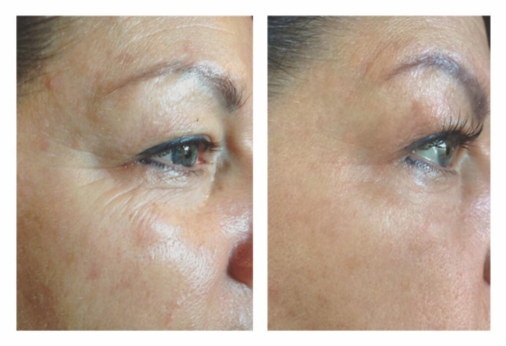 Images Julia Skin Beauty