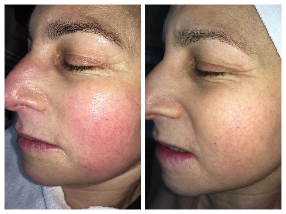 Images Julia Skin Beauty
