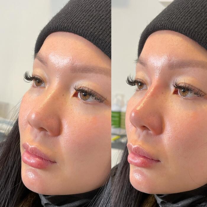 Images Nurse Tran
