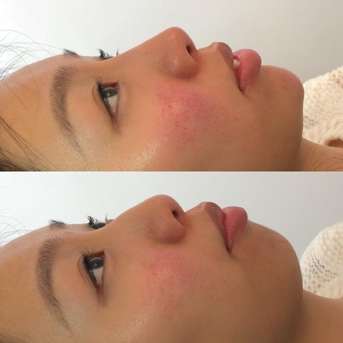 Images Nurse Tran