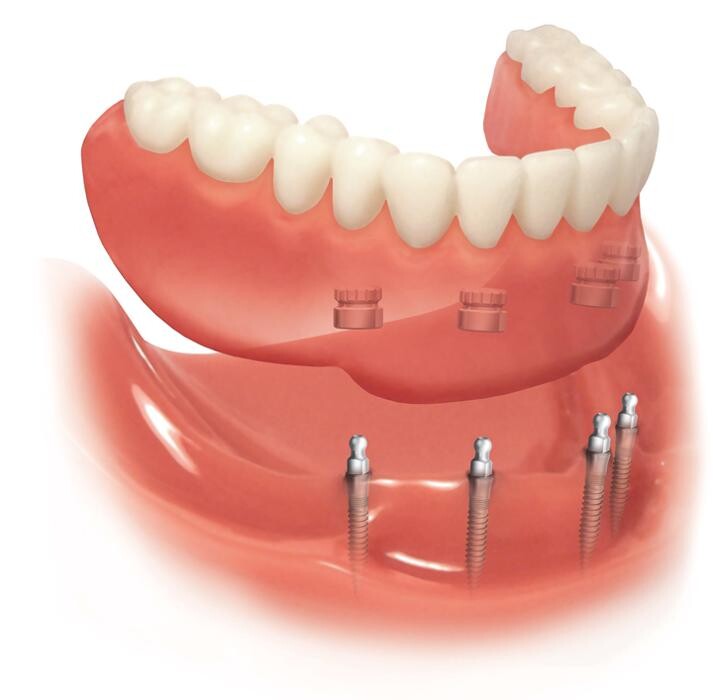 Images Dundas Denture Clinic