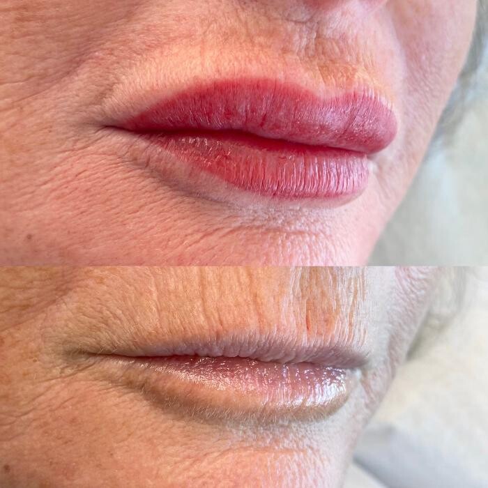 Images Modern You Medical Aesthetics