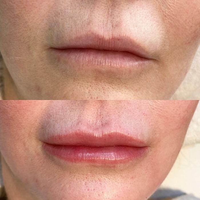 Images Modern You Medical Aesthetics
