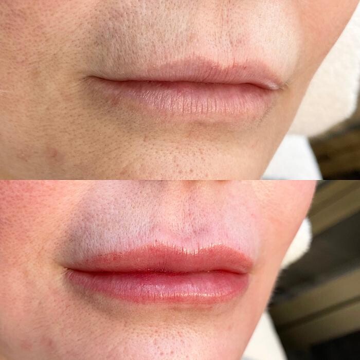 Images Modern You Medical Aesthetics