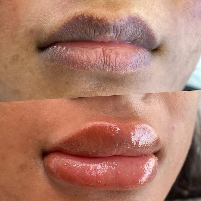 Images Modern You Medical Aesthetics