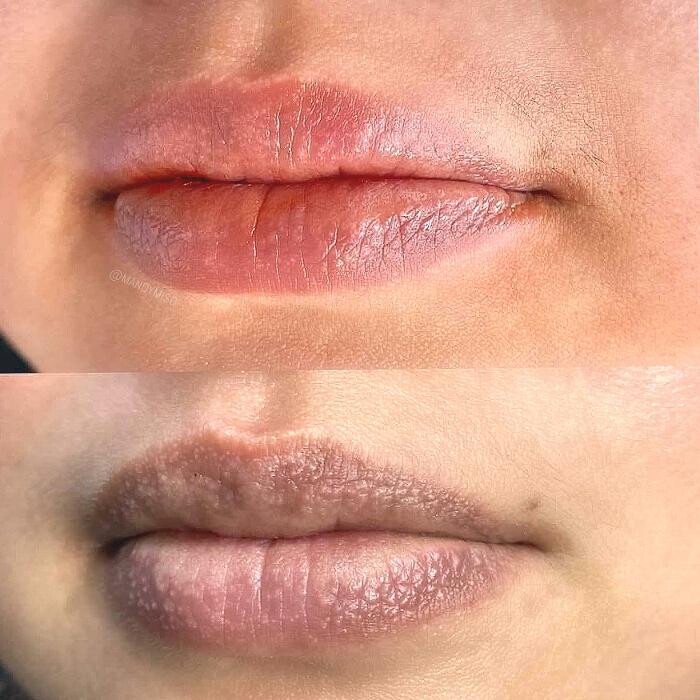 Images Modern You Medical Aesthetics