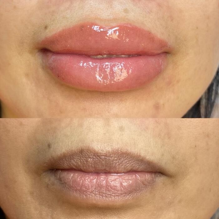Images Modern You Medical Aesthetics