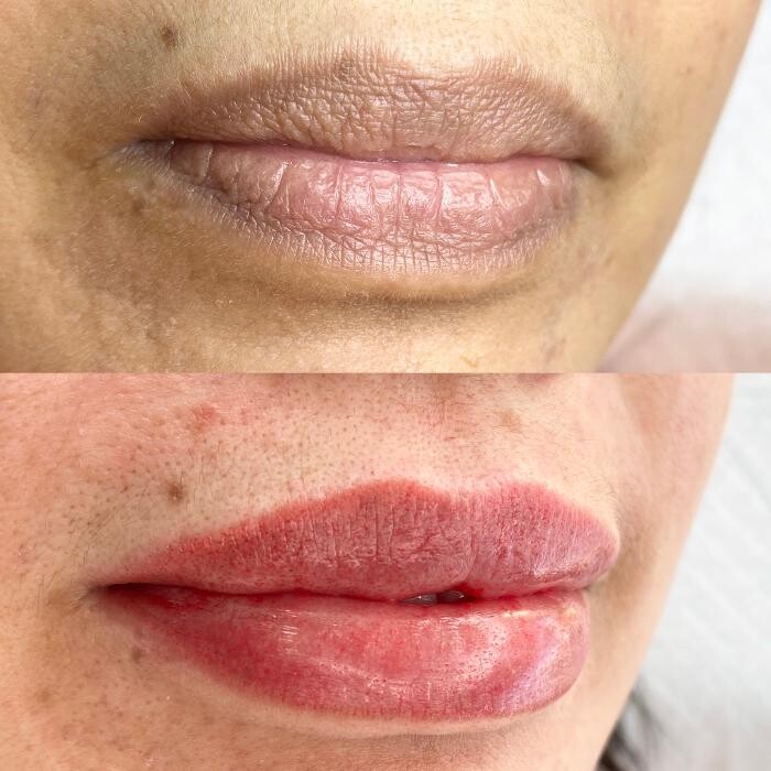 Images Modern You Medical Aesthetics