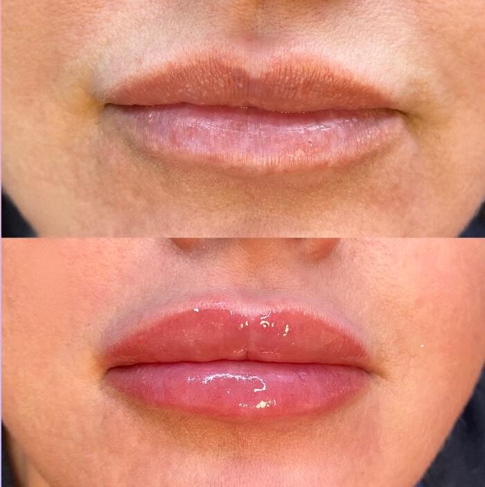 Images Modern You Medical Aesthetics