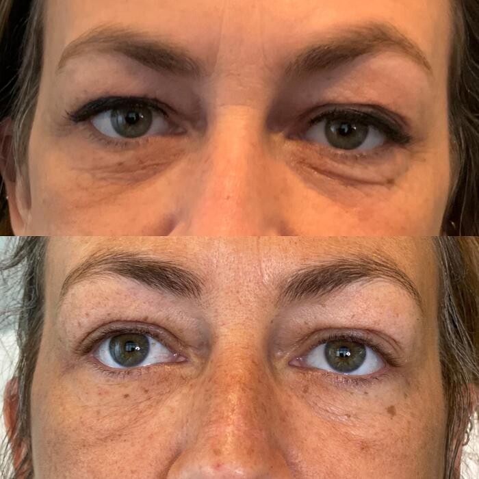 Images Modern You Medical Aesthetics
