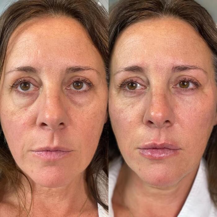 Images Modern You Medical Aesthetics