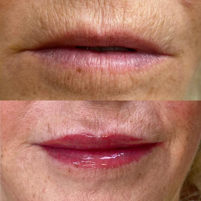 Images Modern You Medical Aesthetics