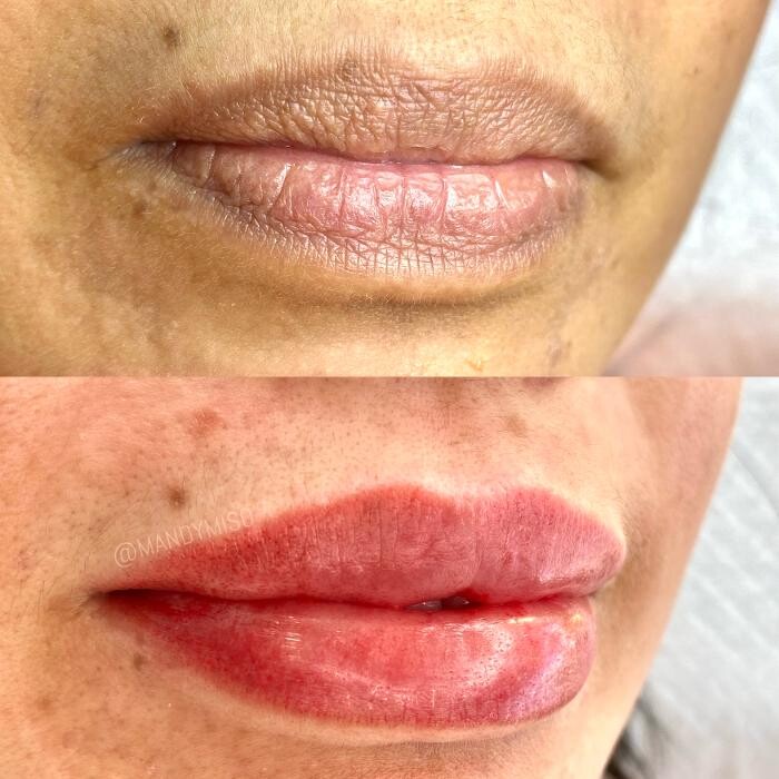 Images Modern You Medical Aesthetics