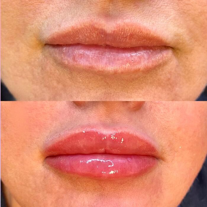 Images Modern You Medical Aesthetics