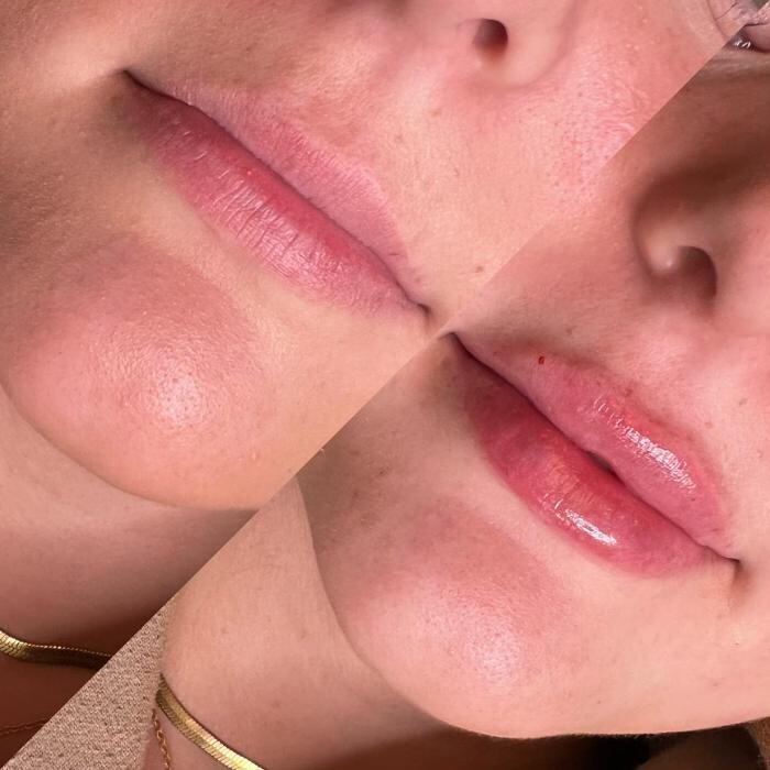 Images Modern You Medical Aesthetics