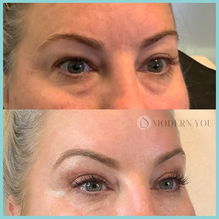 Images Modern You Medical Aesthetics