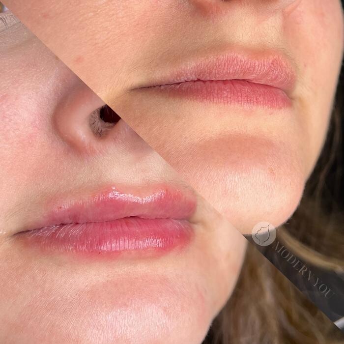 Images Modern You Medical Aesthetics