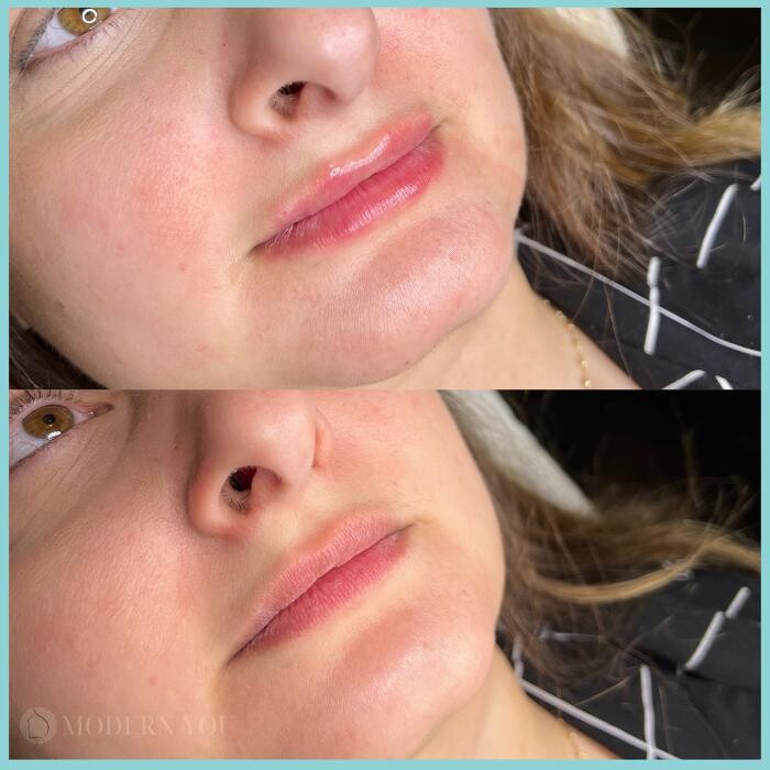 Images Modern You Medical Aesthetics